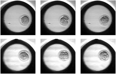 An artificial intelligence algorithm to select most viable embryos considering current process in IVF labs